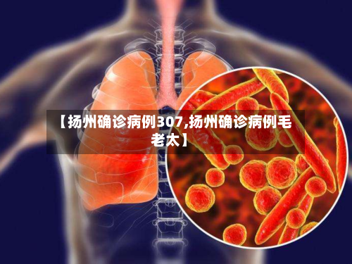 【扬州确诊病例307,扬州确诊病例毛老太】