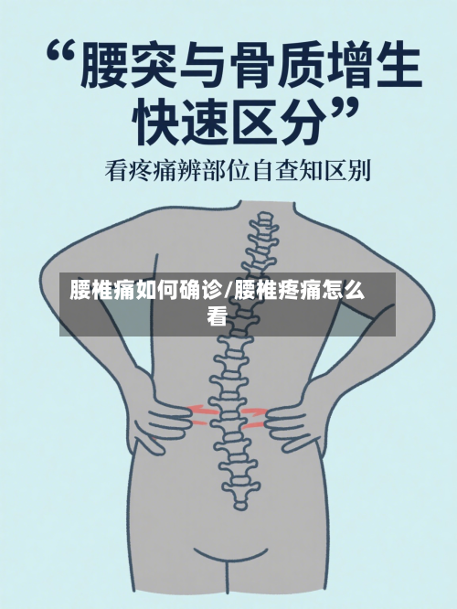腰椎痛如何确诊/腰椎疼痛怎么看