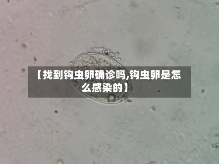 【找到钩虫卵确诊吗,钩虫卵是怎么感染的】