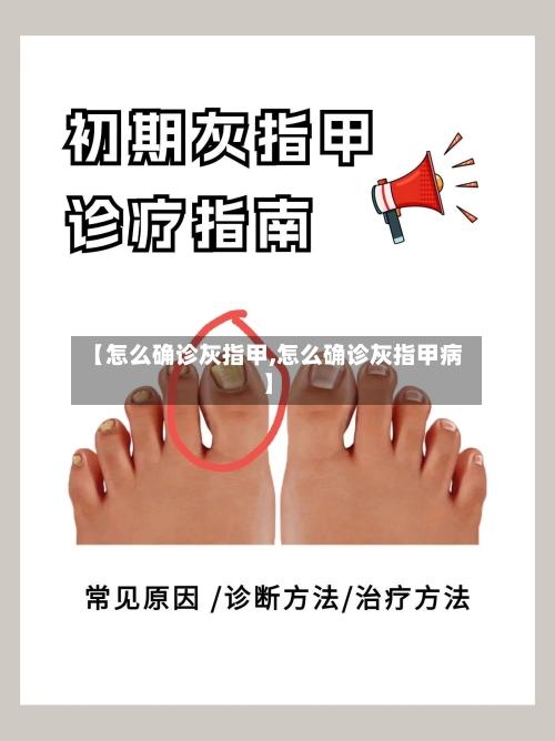 【怎么确诊灰指甲,怎么确诊灰指甲病】