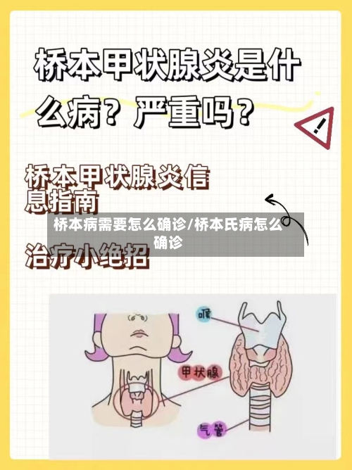 桥本病需要怎么确诊/桥本氏病怎么确诊