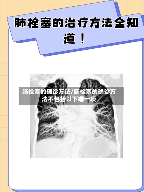 肺栓塞的确诊方法/肺栓塞的确诊方法不包括以下哪一项