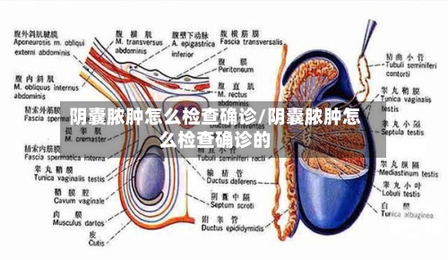 阴囊脓肿怎么检查确诊/阴囊脓肿怎么检查确诊的