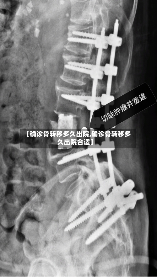 【确诊骨转移多久出院,确诊骨转移多久出院合适】