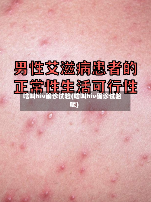啥叫hiv确诊试验(啥叫hiv确诊试验呢)