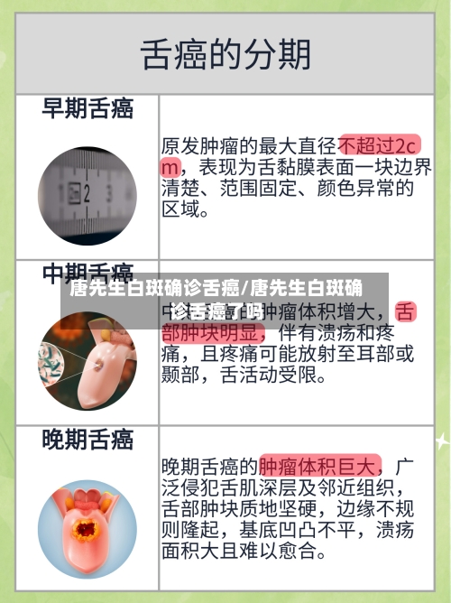唐先生白斑确诊舌癌/唐先生白斑确诊舌癌了吗