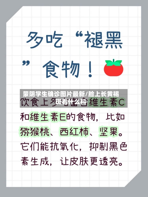 蒙阴学生确诊图片最新/脸上长黄褐斑看什么科
