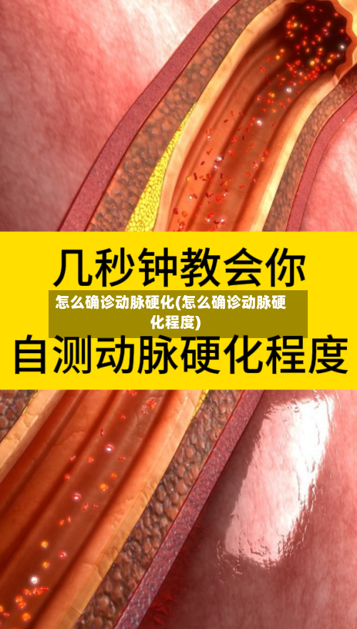 怎么确诊动脉硬化(怎么确诊动脉硬化程度)