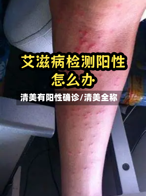 清美有阳性确诊/清美全称