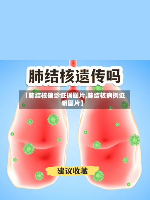 【肺结核确诊证据图片,肺结核病例证明图片】