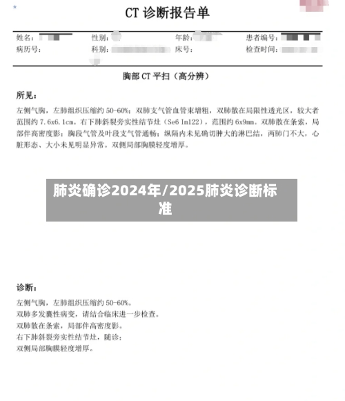 肺炎确诊2024年/2025肺炎诊断标准