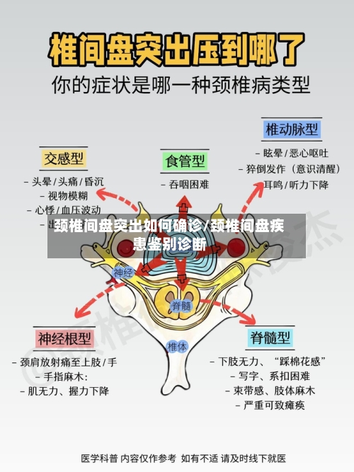颈椎间盘突出如何确诊/颈椎间盘疾患鉴别诊断