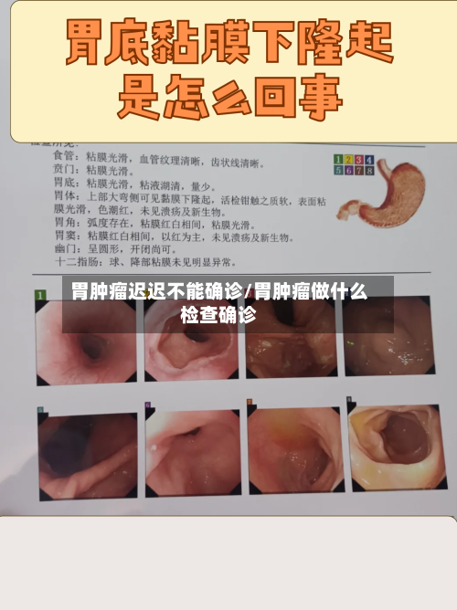 胃肿瘤迟迟不能确诊/胃肿瘤做什么检查确诊