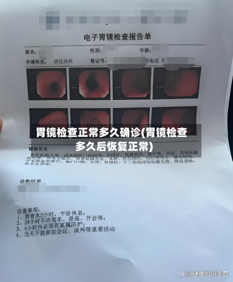 胃镜检查正常多久确诊(胃镜检查多久后恢复正常)