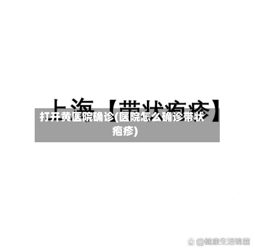 打开黄医院确诊(医院怎么确诊带状疱疹)
