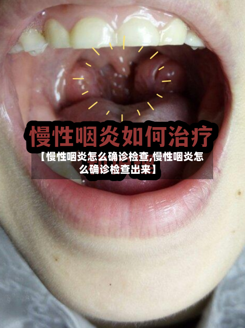 【慢性咽炎怎么确诊检查,慢性咽炎怎么确诊检查出来】