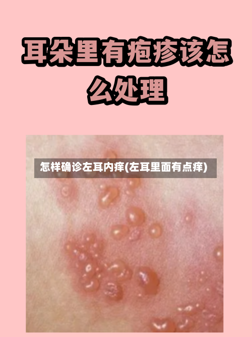 怎样确诊左耳内痒(左耳里面有点痒)