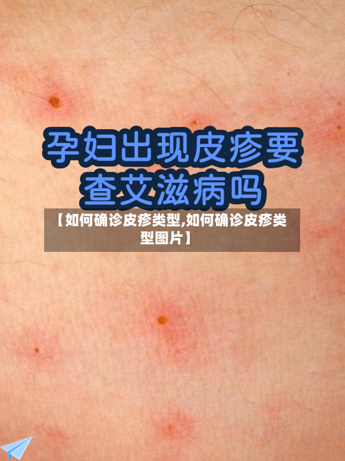 【如何确诊皮疹类型,如何确诊皮疹类型图片】