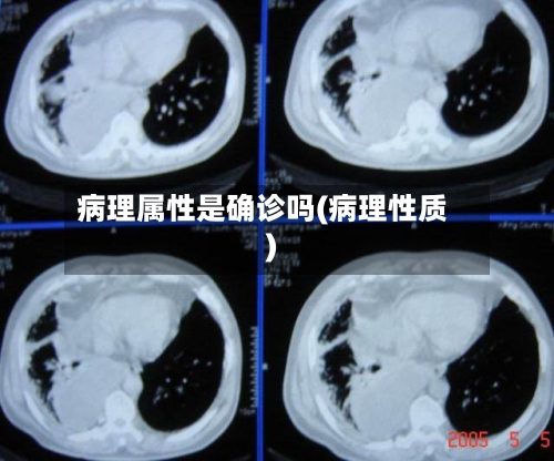 病理属性是确诊吗(病理性质)
