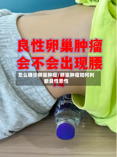 怎么确诊卵巢肿瘤/卵巢肿瘤如何判断良性恶性