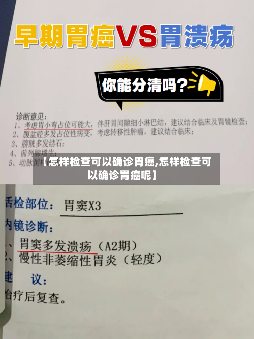 【怎样检查可以确诊胃癌,怎样检查可以确诊胃癌呢】