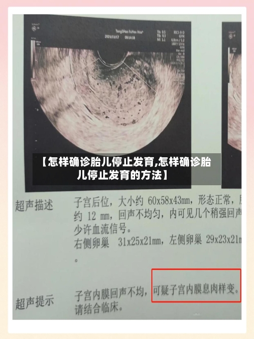 【怎样确诊胎儿停止发育,怎样确诊胎儿停止发育的方法】