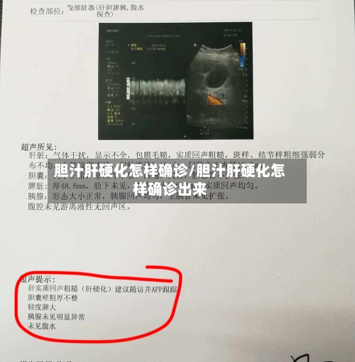 胆汁肝硬化怎样确诊/胆汁肝硬化怎样确诊出来